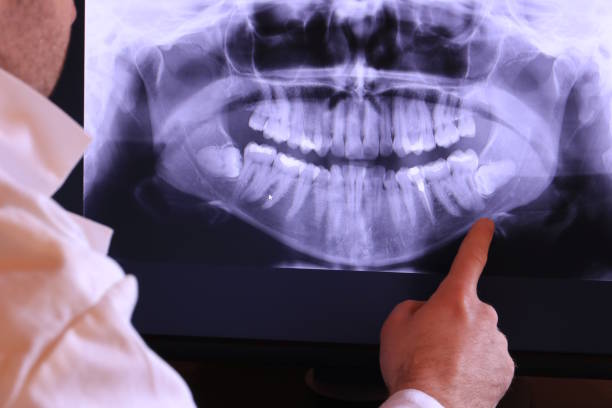 Best Knocked-Out Tooth Emergency  in Clintondale, NY